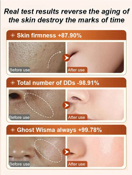 🏆מבצע בזק⚡נמכרו 20K+! כמעט אזל💥סרום נגד קמטים להדקות ולהלחות