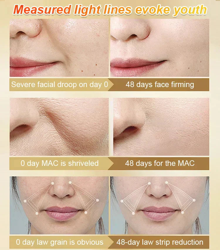 🏆מבצע בזק⚡נמכרו 20K+! כמעט אזל💥סרום נגד קמטים להדקות ולהלחות